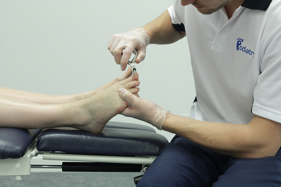 Thick Toenails – Symptoms, Diagnosis and Treatment – Da Vinci Foot
